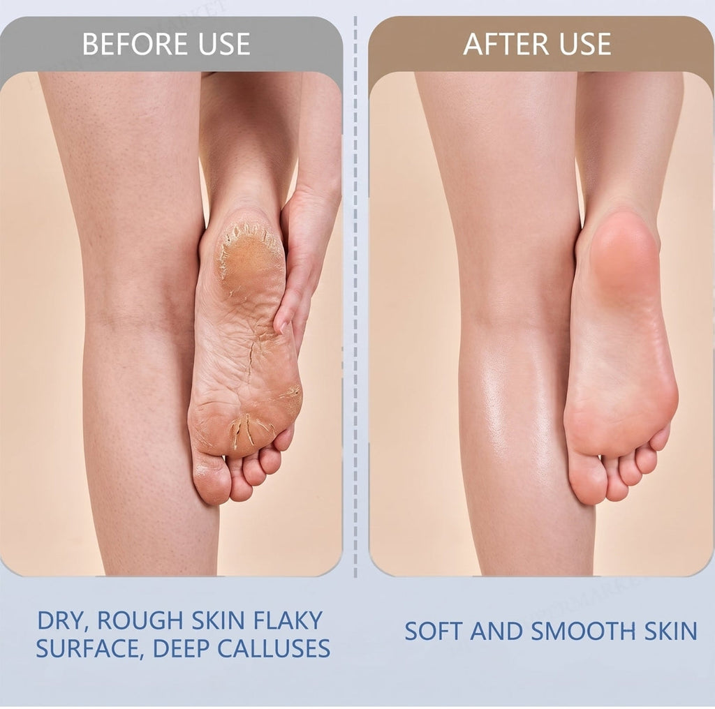 Electric Foot File Callus Remover - additional view