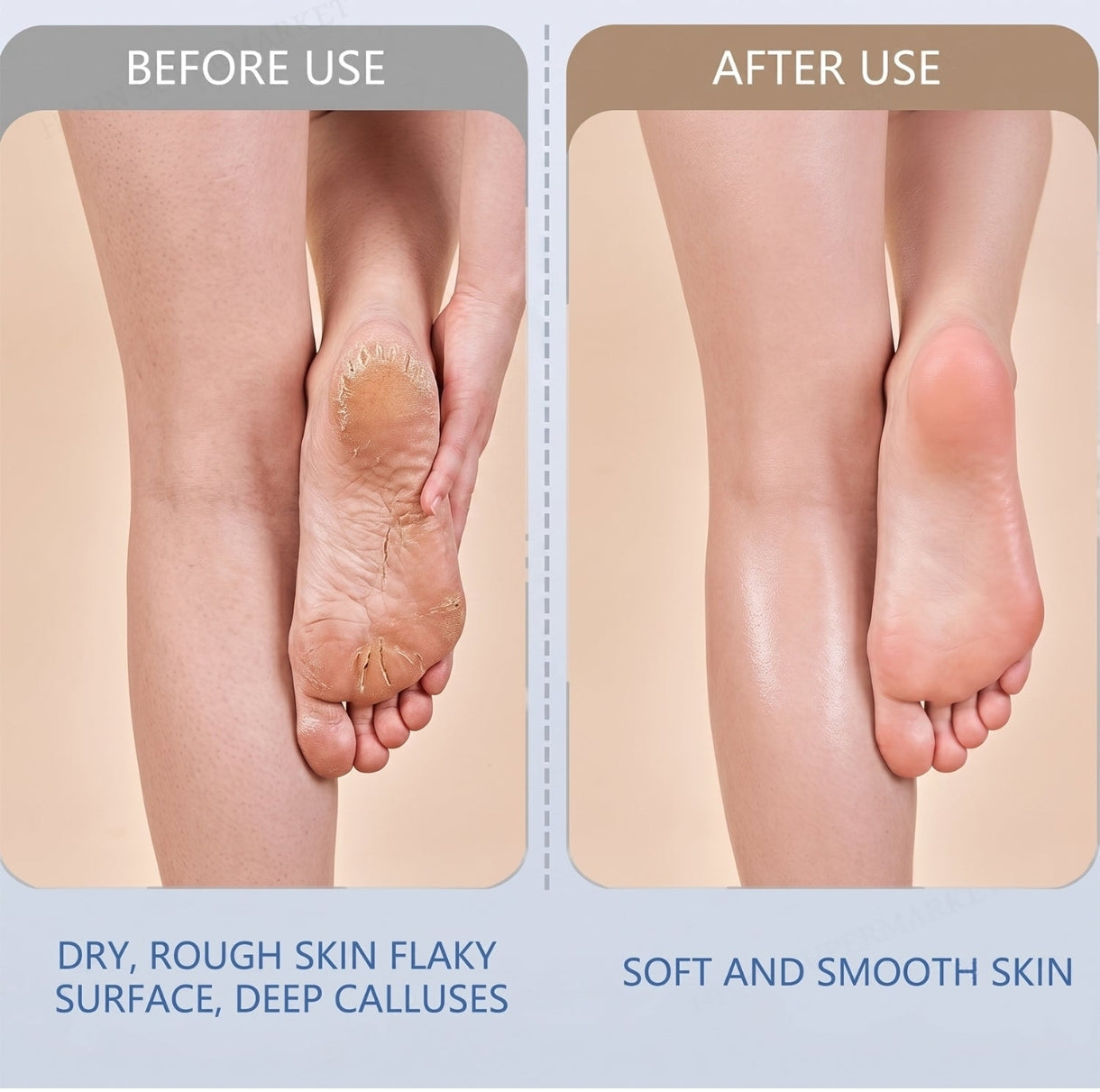 Electric Foot File Callus Remover - additional view